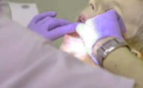 (薦)拔牙記作文