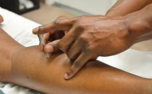 ᘾ�����Ѩλ����Щ��