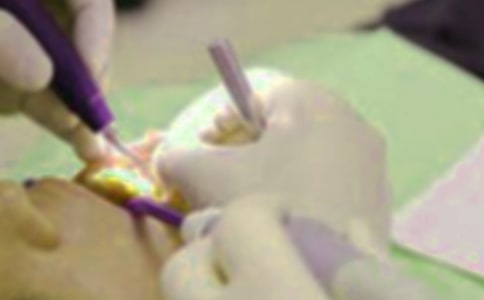 拔牙記作文【匯總15篇】