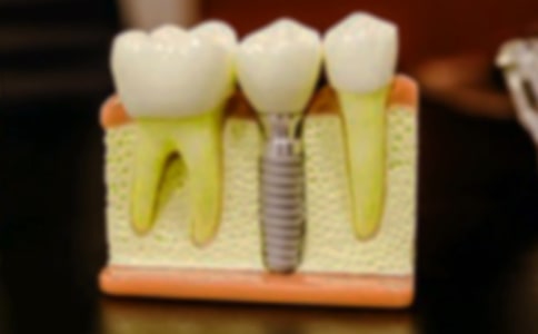 ����ӛ���ģ��ϼ�15ƪ��