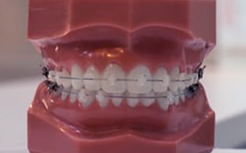 治療牙齦腫脹有妙方