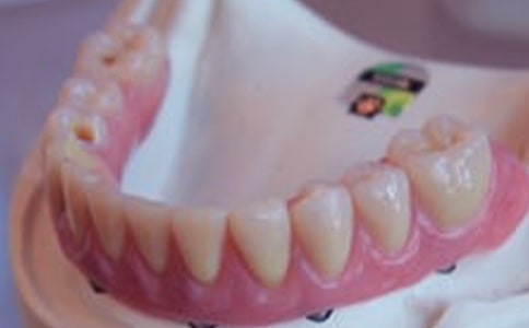 刷牙的正確方法-刷牙時牙齦出血怎么辦?