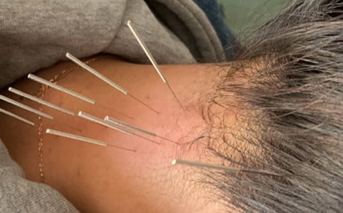 ᘾ����ÿƌ�(sh��)�`�ĵ�