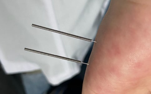 針灸科年終工作總結(精選16篇)